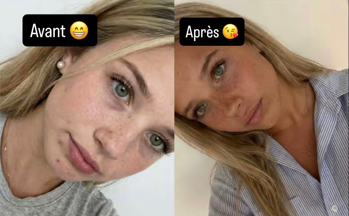 Glow Intensif (3 mois)